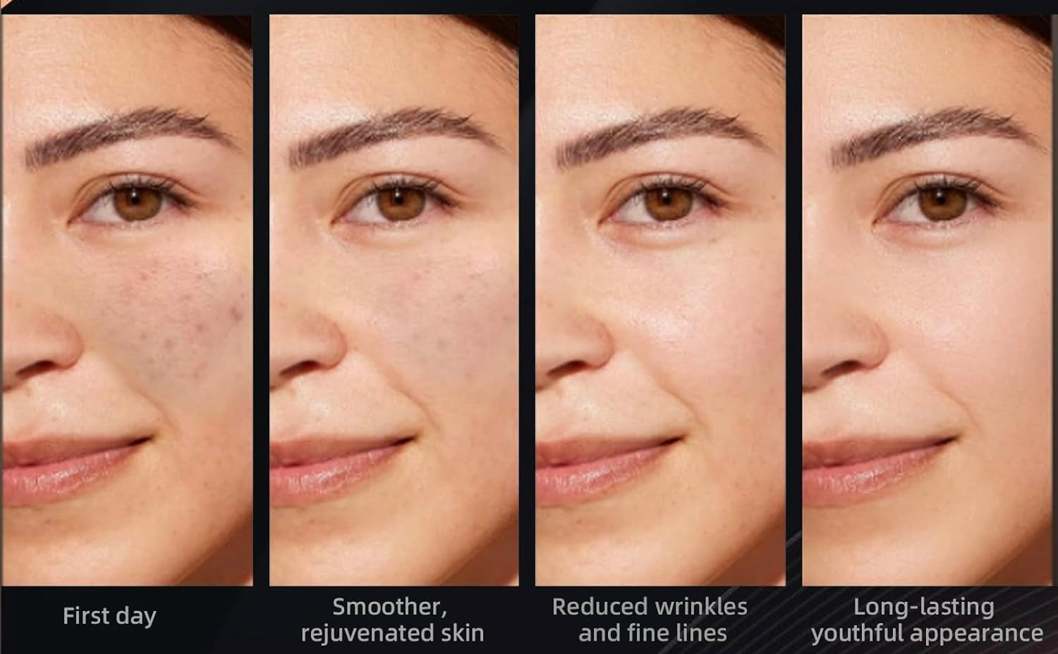 SSKIN Glow Red Light Therapy Mask